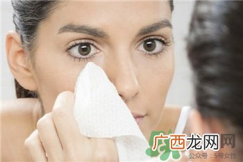 闭口粉刺是怎么形成的?闭口粉刺的改善方法