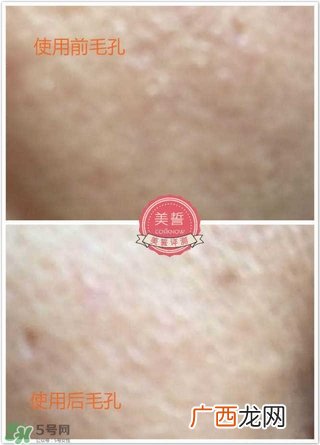 nuface美容仪怎么样?nuface美容仪有用吗?