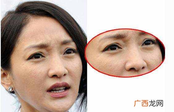 卡粉是什么意思？卡粉和浮粉有什么区别？
