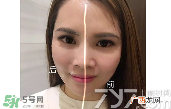 黄金棒有什么用？黄金棒的功效与作用
