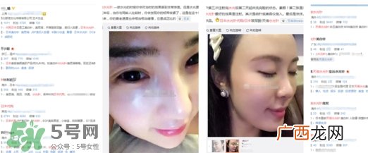 天倍面膜是日本的吗？日本tenbe天倍面膜骗局