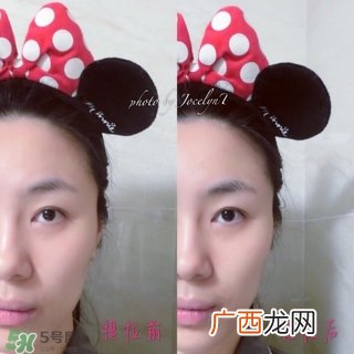 松下eh-sc65洁面仪怎么样_好用吗
