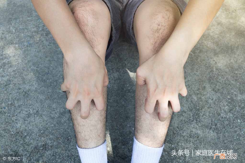腿上长小红点？腿上起了红疙瘩，还很痒？5个“祸首”