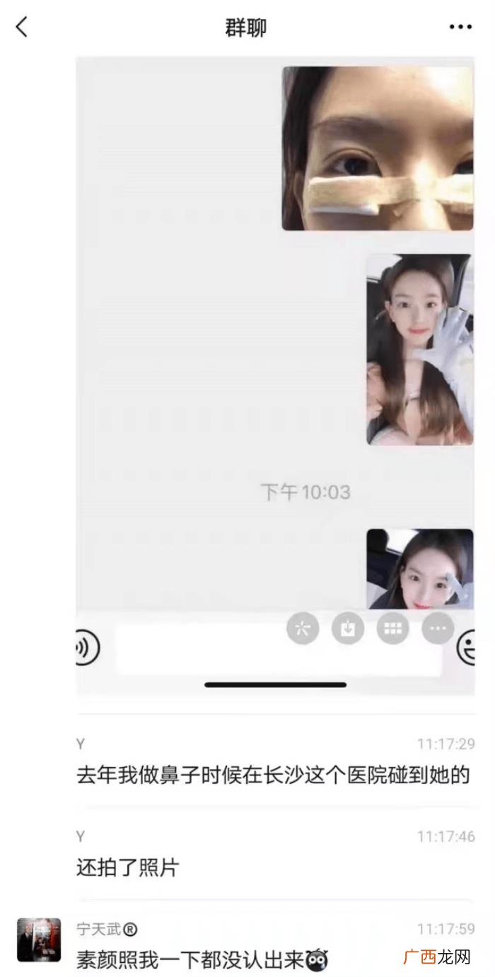 整过的鼻子，整容医生直言孙一宁动过鼻子整容痕迹明显