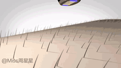 smooth skin脱毛仪怎么用?smoothskin慕金脱毛仪使用方法