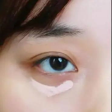 天生黑眼圈，但我的黑眼圈真的是天生的.....