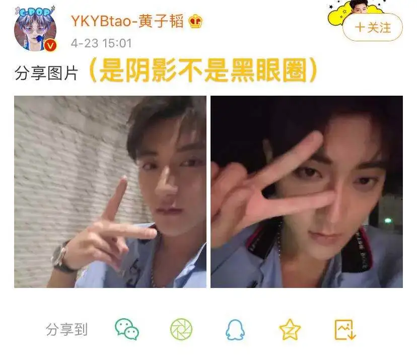 天生黑眼圈，但我的黑眼圈真的是天生的.....