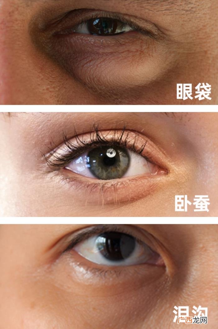 天生黑眼圈，但我的黑眼圈真的是天生的.....
