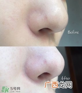 the beautools rocklean毛孔清洁器黑金版和普通版区别