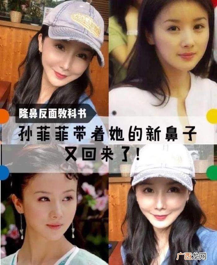 死在整容手术台的明星，有的命丧手术台