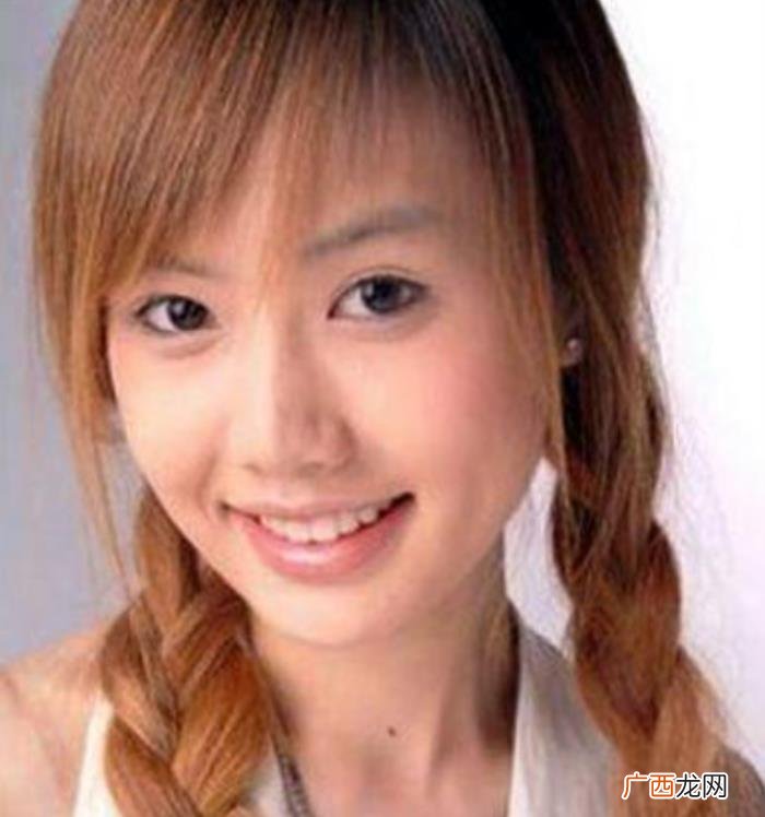 死在整容手术台的明星，有的命丧手术台