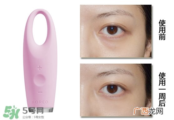 foreo眼部按摩仪好用吗？foreo iris眼部按摩仪副作用