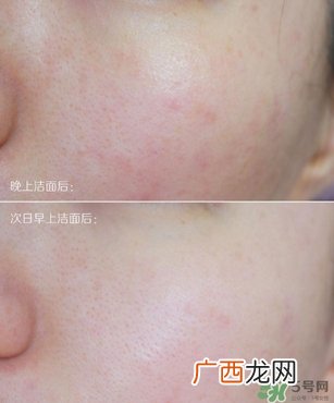 Endocare明星产品推荐 安多可哪些产品好用