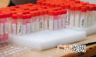 核酸常温可以放多久啊 核酸常温能放多久啊