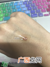 日本msd祛疤膏怎么样？日本msd祛疤膏有用吗？