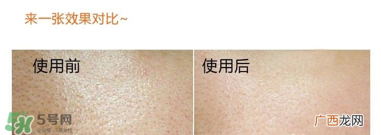 城野医生毛孔收敛水真的有用吗