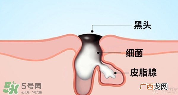 城野医生毛孔收敛水真的有用吗