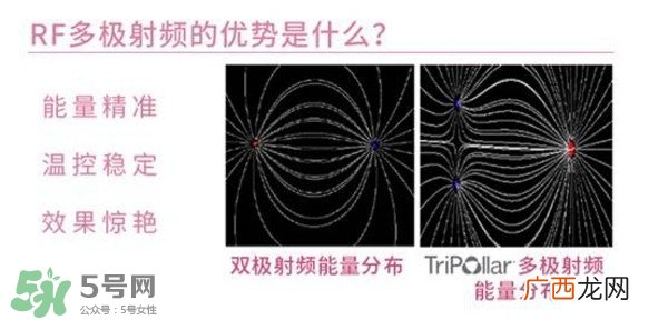 tripollar stop怎么样？tripollar pose好用吗