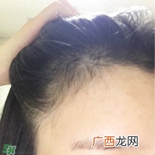 aveda生发喷雾怎么用?aveda生发喷雾使用方法