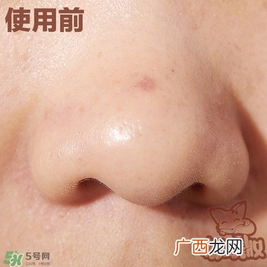 melty berry去黑头使用方法 melty berry草莓鼻去黑头怎么用