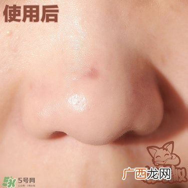 melty berry去黑头使用方法 melty berry草莓鼻去黑头怎么用