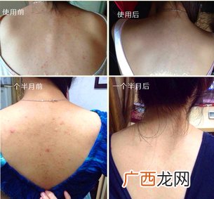sana美背喷雾两种款式区别 sana美背喷雾新旧包装对比