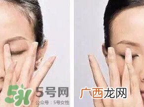 用眼霜过敏了怎么办,眼霜过敏红肿怎么办