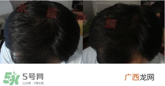 资生堂不老林洗发水怎么样？资生堂不老林洗发水能长头发吗
