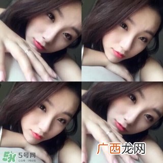 混合偏油性皮肤怎么祛痘 战痘小经验