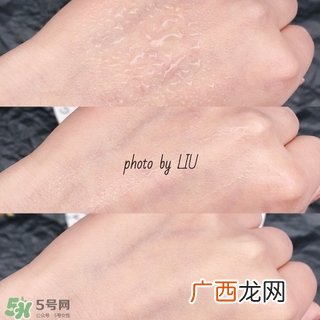 美帕b5喷雾有激素吗?美帕喷雾副作用
