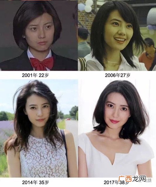 什么是密集护理？如何做皮肤密集护理