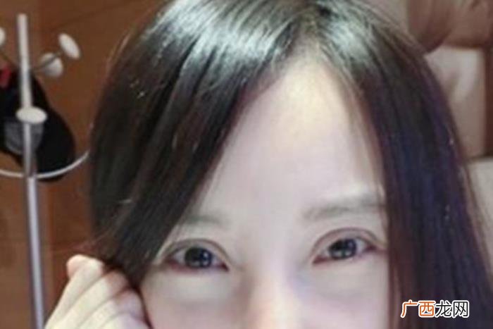 欧式双眼皮，欧式双眼皮没你们传的那么美的神乎其神