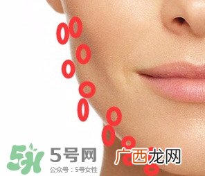 nuface美容仪有效吗？nuface美容仪副作用？