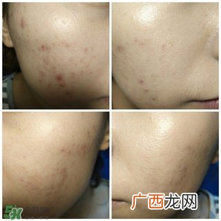 爱敬气垫适合什么肤质 爱敬水粉霜适合什么肤质