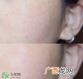 rosamin若美欣杏仁酸精华液怎么样_好用吗