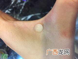 viscontour玻尿酸精华怎么样?维诗朵玻尿酸精华好用吗?