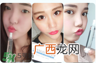 玻尿酸原液有副作用吗 玻尿酸原液有危害吗