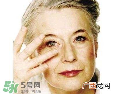 老年斑是怎么形成的？老年斑的形成原因
