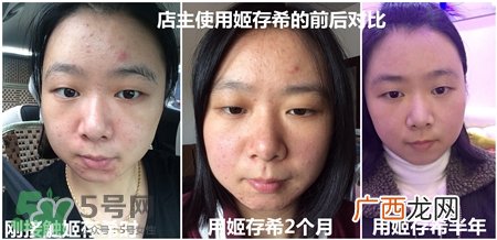 姬存希四件套里面有什么?姬存希美肌四件套怎么样?