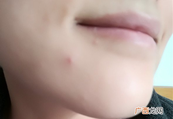 美康粉黛适合什么年龄？美康粉黛适合年龄段