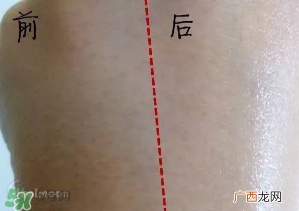 兰蔻大眼精华和雅诗兰黛小棕瓶哪个好？兰蔻大眼精华和小棕瓶对比