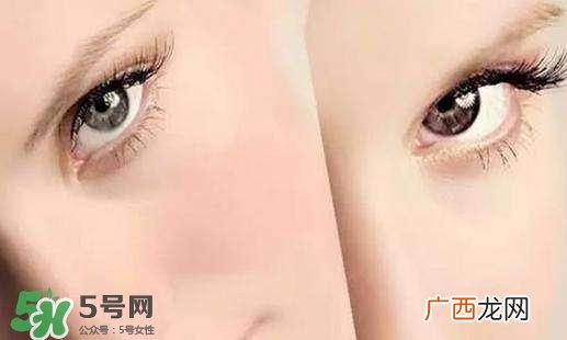 如何防止眼部衰老 如何延缓眼部衰老