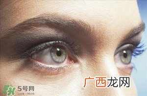 黑眼圈怎么去除小窍门 黑眼圈怎么办