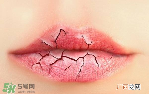 唇纹怎么去 唇纹深怎么办