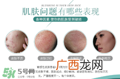 敏感肌肤可以用精油吗 敏感皮肤可以用精油吗