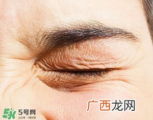 去皱最好的方法 最有效的去皱方法