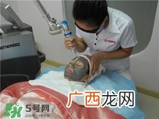 黑脸娃娃是什么？黑脸娃娃的效果好不好？