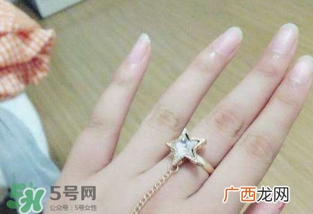 手上长倒刺可以拔吗?手上长倒刺能拔吗?