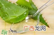 脸上长痘痘可以擦芦荟吗?脸上长痘痘擦芦荟有用吗?