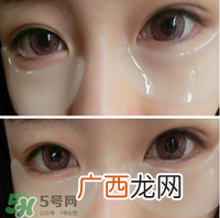 贴眼膜有刺痛感 眼膜贴着有刺痛感